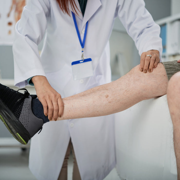 Varicose Veins <br> Symptoms, Causes, Risk Factors & Treatment